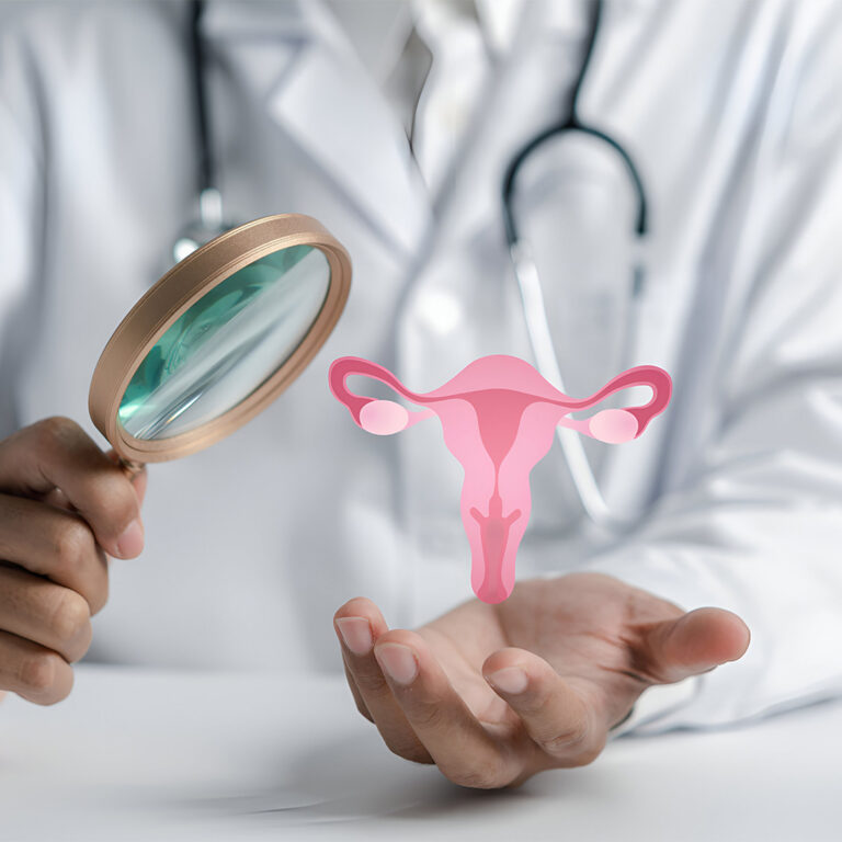 Cervical Cancer