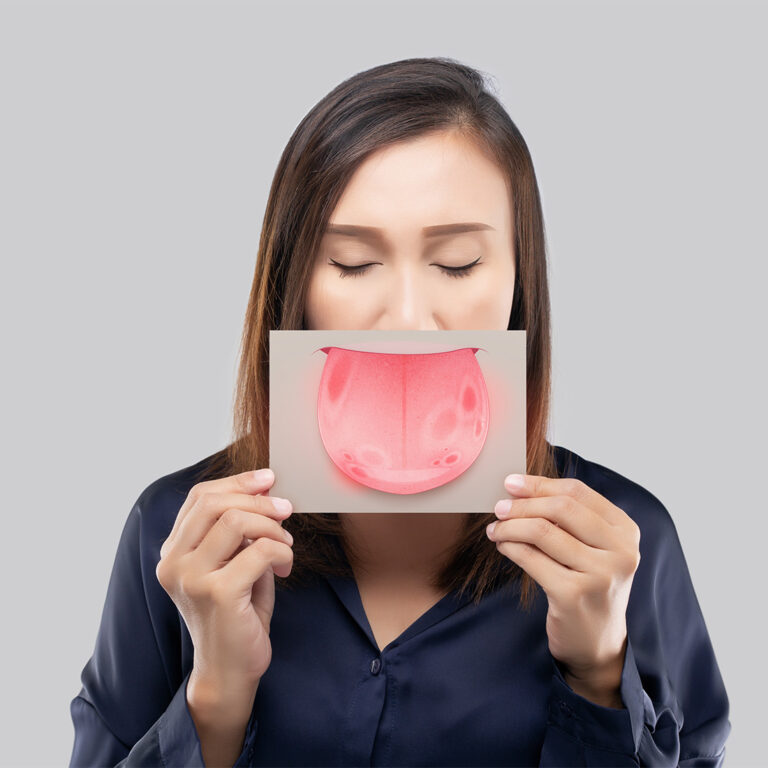 Oral Cancer